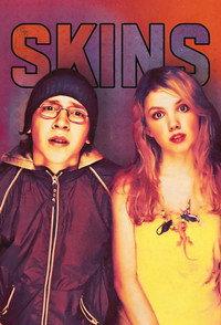 Skins-スキンズ