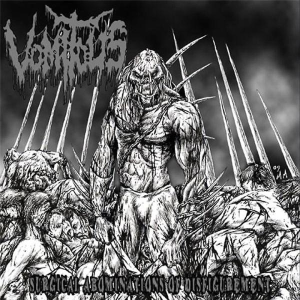 Intrauterine Decimation