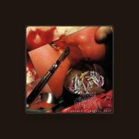 Fleshgrinder