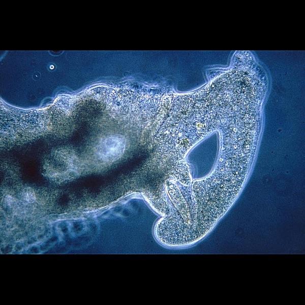 Amoeba