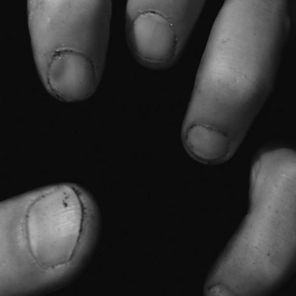 Dirty Fingernails (Dirk Leyers Remix)