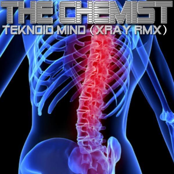 Teknoid Mind (Xray Remix)