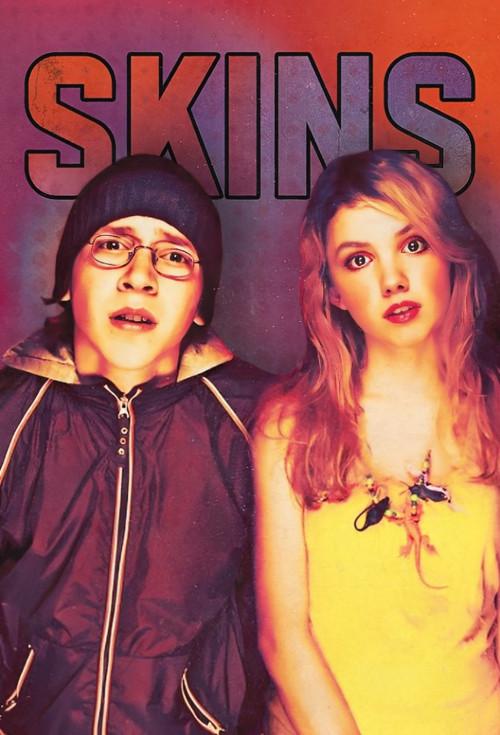 Skins-スキンズ